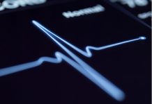 Un algoritm ar putea diagnostica bolile cardiace mai bine decât medicul ?