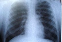 Plămânii se îmbolnăvesc când ne este frică de moarte