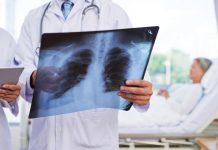 Pneumonia, netratată, poate duce la deces