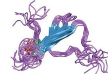 Proteinele „tau”- cauza pentru care vârstnicii dezvoltă mai des Alzheimer