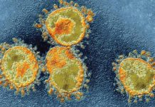 Apariţia ”furtunii de citokine” la unii pacienţi cu COVID-19 ar putea fi prezisă cu ajutorul unor markeri