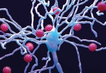 Psihoză COVID-19: Cercetătorii studiază dacă organismul atacă din greşeală creierul după infectare