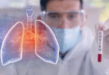 Simptomele persistente după 12 luni, în cazul pacienţilor diagnosticaţi cu coronavirus, este posibil să se regăsească şi la 18 luni