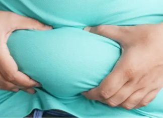 Medicul Andra Balcangiu-Stroescu: 40% din populaţia României suferă de obezitate