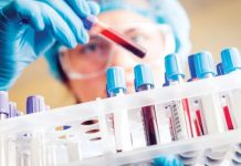 Oamenii de ştiinţă au descoperit o genă care poate creşte riscul de cancer al sângelui