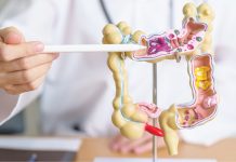 Un nou test ajută la detectarea cancerului colorectal incipient