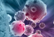 Cercetătorii consideră că modalitatea de clasificare a cancerelor trebuie să se schimbe