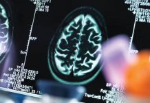 A fost identificat un mecanism natural din creier care favorizează eliminarea plăcilor toxice implicate în Alzheimer