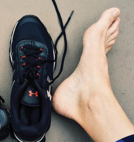 unghii incarnate _ incaltaminte stramta